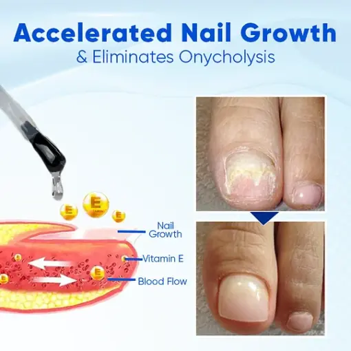 ROSOPL™ OnyxoGuard Nail Growth and Repair Serum - Image 4