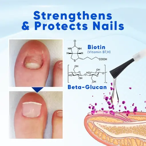 ROSOPL™ OnyxoGuard Nail Growth and Repair Serum - Image 2