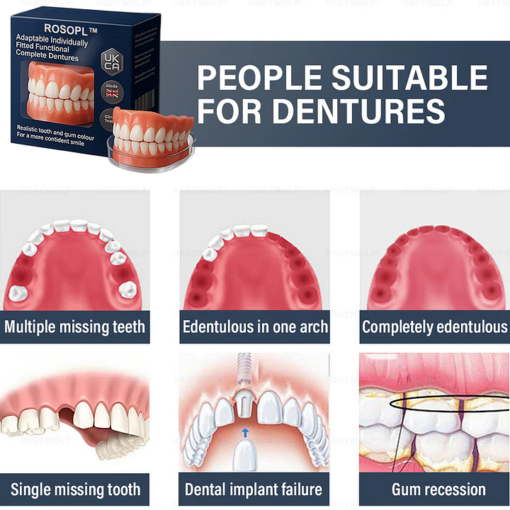 ROSOPL™ Adaptable Custom-Fit Functional Complete Dentures - Image 3