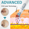 ROSOPL® SpotAway Painless Laser Mole Removal Pen