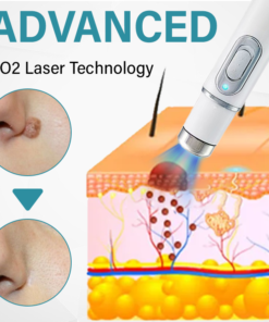 ROSOPL® SpotAway Painless Laser Mole Removal Pen