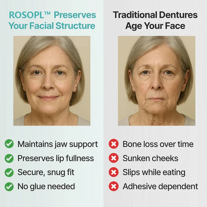 ROSOPL™ Custom-Fit Dentures - Image 2
