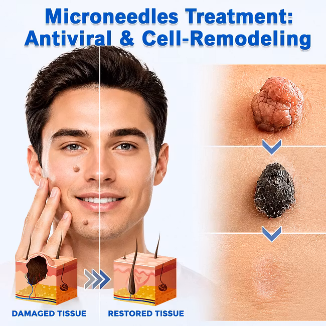 ROSOPL® 2-in-1 Microneedle & Hydrocolloid Patch - Image 2