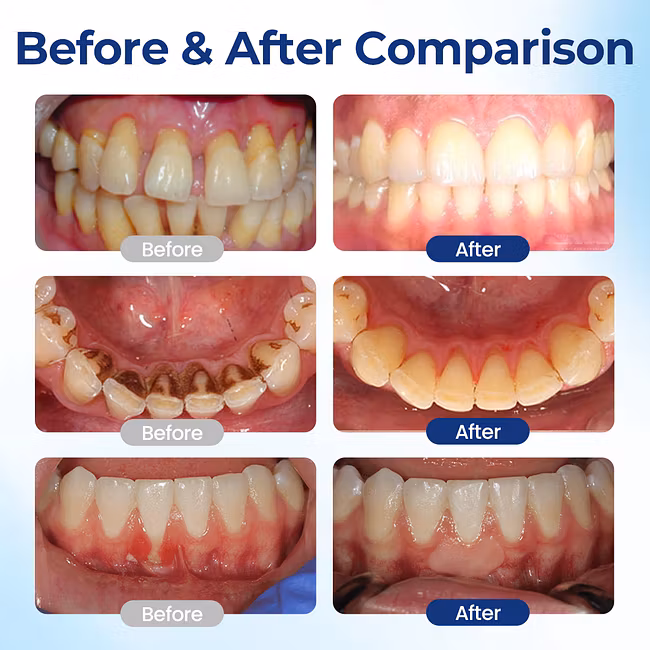 ROSOPL™ BeeTakt Oral Repair Solution - Image 3